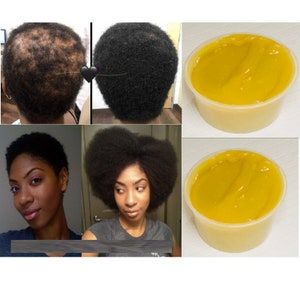 Fast Hair Growth Butter Made With Shea Butter for Thinning | Etsy Hair Growth Cream, Hair Grease, Make Hair Thicker, Castor Oil For Hair Growth, Grease Hairstyles, Hair Growth Secrets, Growth Hair, Edges Hair, Castor Oil For Hair