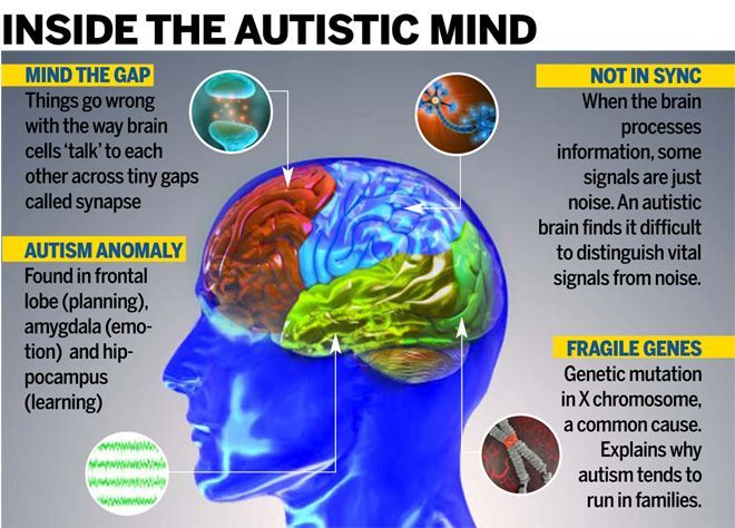 Image result for neurotypical brain vs autistic brain Brain Study, Ordinary Extraordinary, Human Body Anatomy, Psychology Student, Mind The Gap, Spectrum Disorder, Sensory Processing, Learning Disabilities, Conflict Resolution