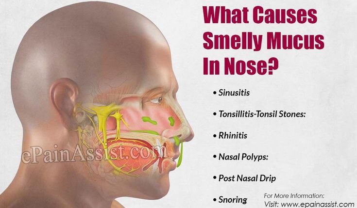 #ThroatSnoringRemedies Clear Mucus From Throat, Phlegm In Throat, Mucus In Throat, Getting Rid Of Mucus, Chest Congestion Remedies, Mucus Relief, Getting Rid Of Phlegm, Congestion Remedies, Sinus Cavities