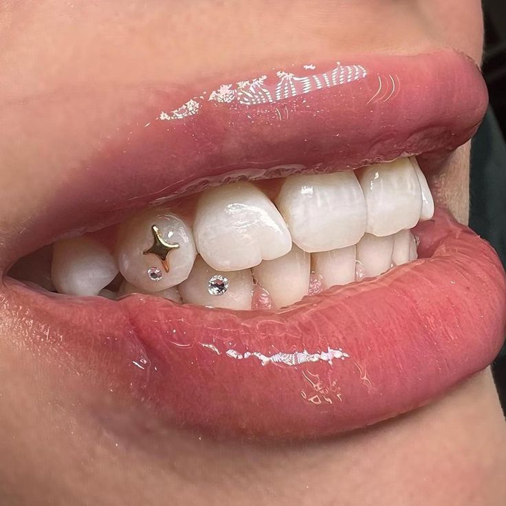 a woman's mouth with white teeth and red lipstick on top of her lips