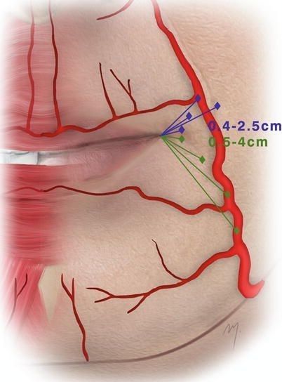 Lips Anatomy, Vascular Anatomy, Aesthetic Dermatology, Facial Anatomy, Face Anatomy, Facial Fillers, Facial Contouring, Cosmetic Injectables, Lip Augmentation