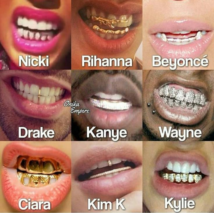 These look cool! Braces Grillz, Girls With Grills, Girl Grillz, Teeth Grills, Cute Braces Colors, Pretty Teeth, Grillz Teeth, Grill Ideas, Cute Braces