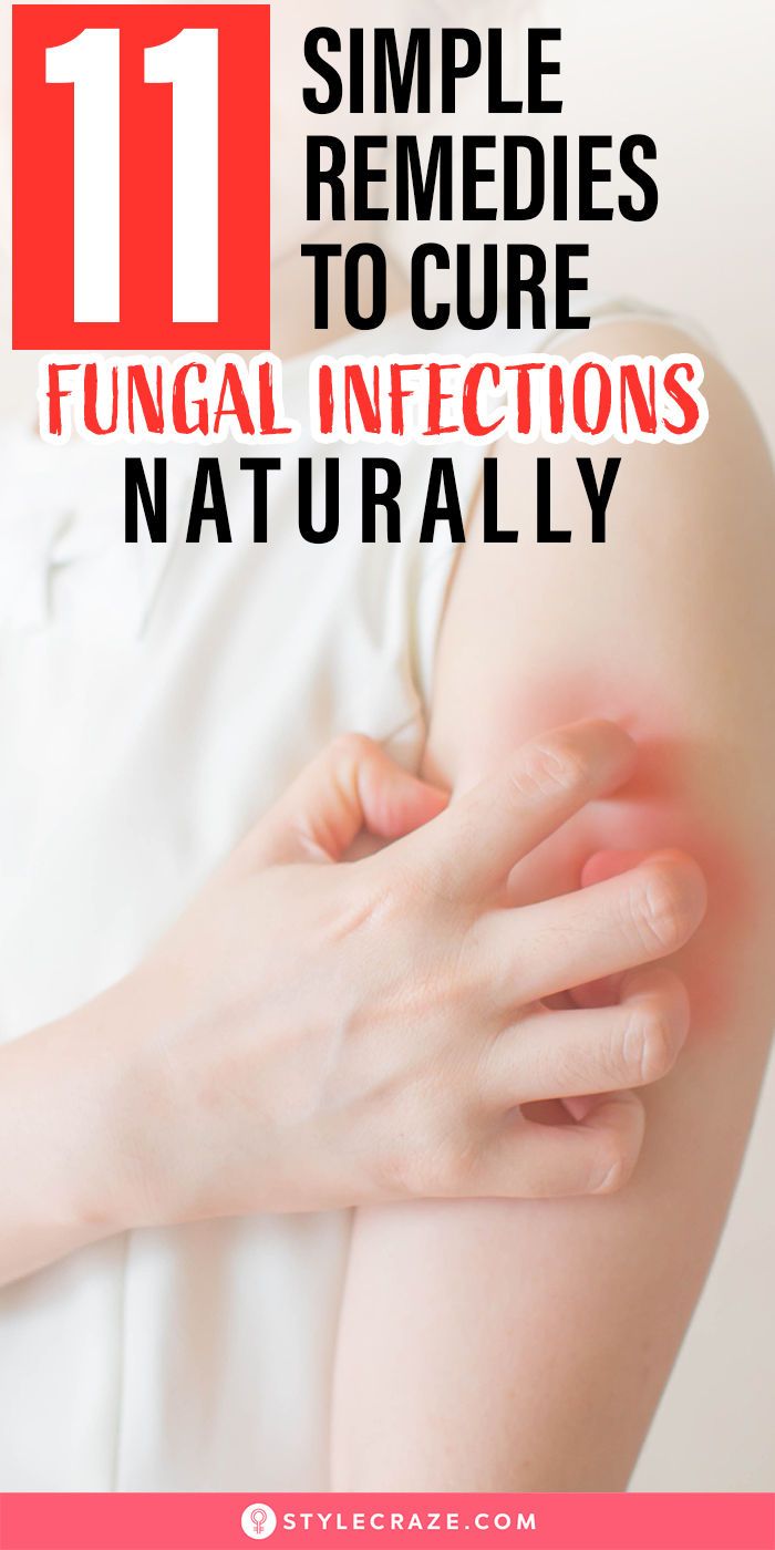 It is important to try various medicinal techniques, both internal and external, to get rid of fungal skin infections. Research states that over a billion people usually suffer from hair, skin, or even nail infections caused by fungus or other bacteria.