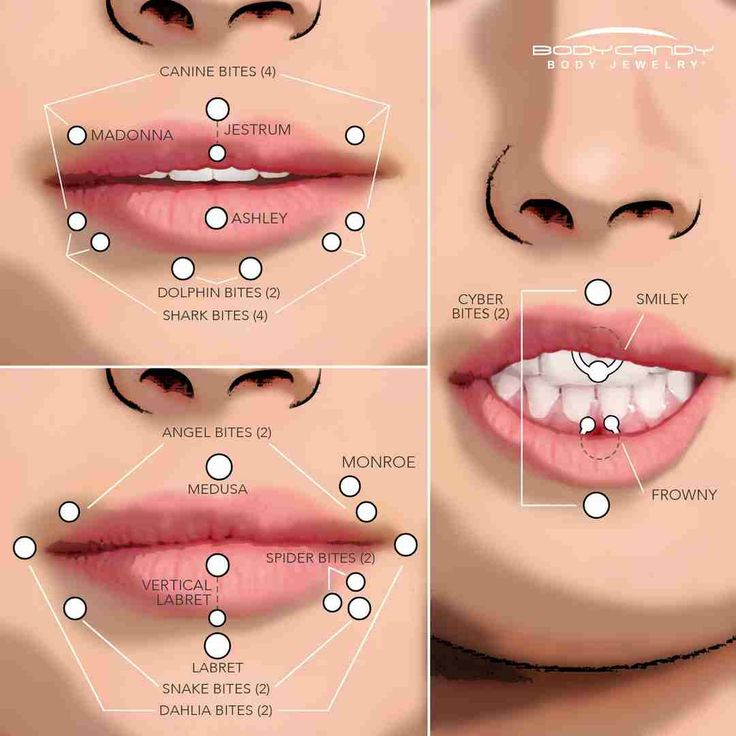 the procedure is performed to remove gums from lips