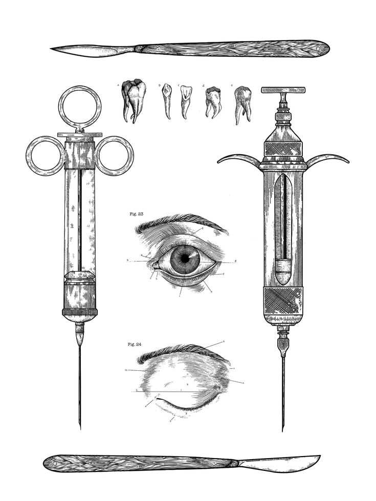 an image of medical instruments and tools drawn by hand in pencil on white paper with black ink