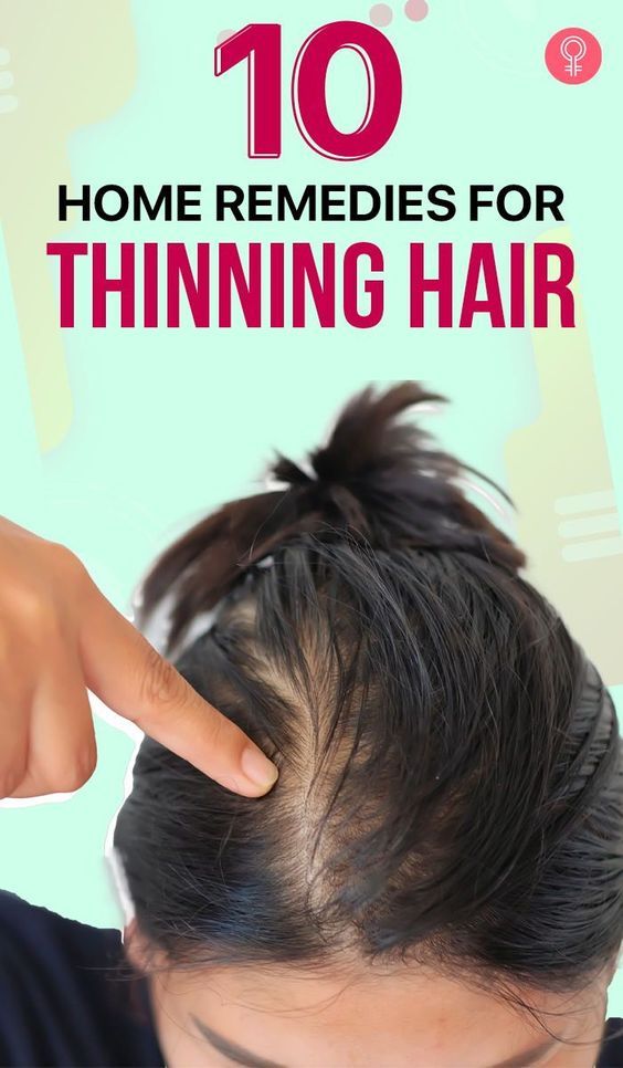 10 Home Remedies For Thinning Hair: While various medical treatments treat hair loss quickly, a few ingredients from the pantry can effectively treat your problem and give you strong and healthy hair in the long run. In this article, we look at a few home remedies and tips you can follow to reduce thinning hair. #haircare #hairthinning #haircaretips #remedies #homeremedies Remedies For Thinning Hair, Treat Thinning Hair, Thinning Hair Remedies, Homemade Hair Treatments, Healthy Natural Hair Growth, Natural Hair Treatments, Hair Care Growth, Hair Growing Tips, Hair Remedies For Growth