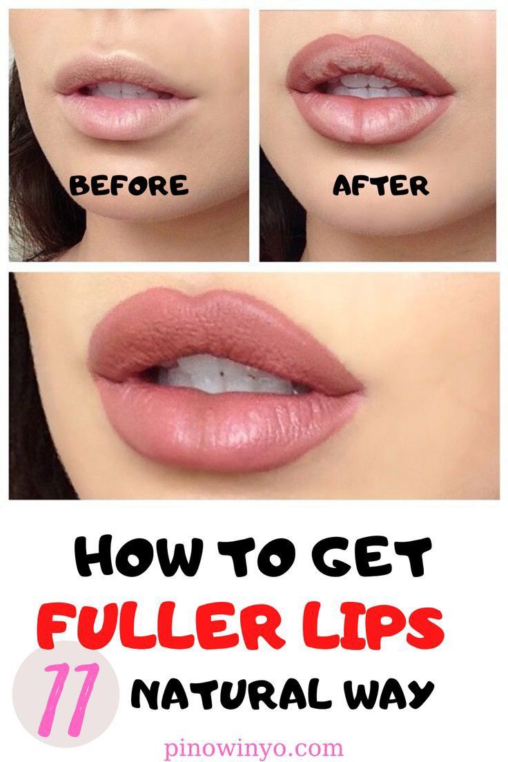 Get Fuller Lips Naturally, Make Lips Bigger, Bigger Lips Naturally, Fuller Lips Naturally, Fuller Lips, How To Get Bigger, Lip Makeup Tutorial, Women Health Care, Makeup Mistakes