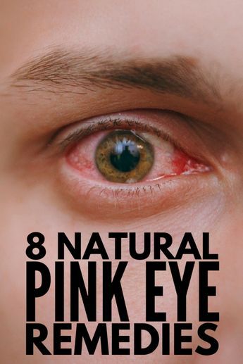 Home Remedies for Pink Eye: 8 Natural Remedies for Pink Eye that Work! Pink Eye Remedies, Remedies For Pink Eye, Pink Eye Home Remedies, Natural Pink Eye Remedy, Health Benefits Of Grapefruit, Narrow Laundry, Pinkeye Remedies, Home Remedies For Bronchitis, Best Cough Remedy