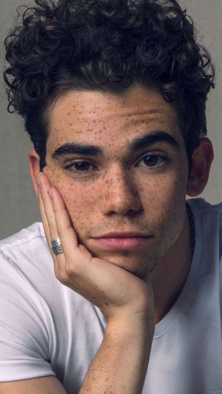 a young man with freckles on his face and hands resting against his chin