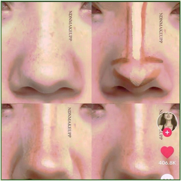 If You Pick Your Nose, You Should Probably Stop Now. This Is How Dangerous It Can Be. – Koperacija We all do it from time to time. We feel an itch or scratch and the next thing we know we’re sticking... Nose Tutorial, Nose Tip, Bulbous Nose, Hooked Nose, Nose Types, Nose Contour, Straight Nose, Nose Makeup, Wide Nose