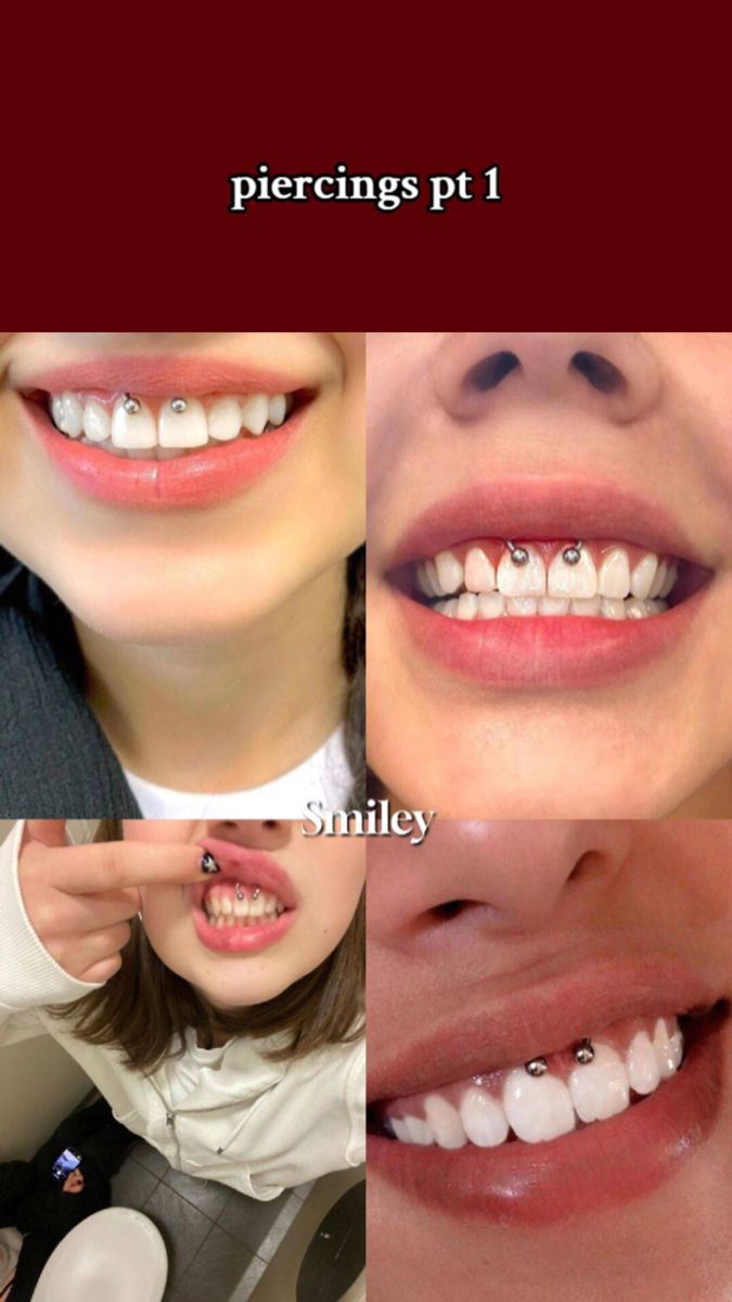 four different pictures of people smiling and brushing their teeth with braces on top of them