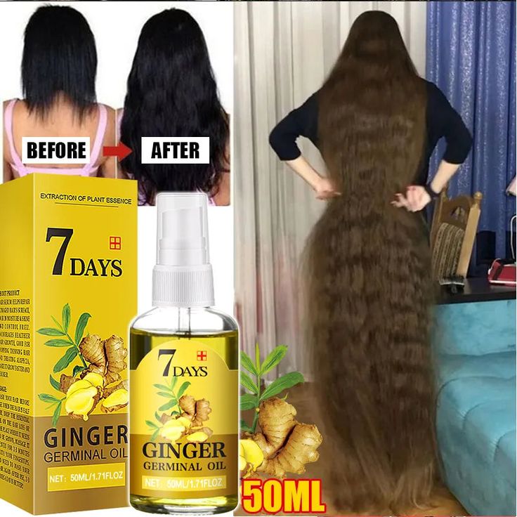 SPECIFICATIONS Number of Pieces: One Unit NET WT: 10ml/20ml/30ml/50ml Item Type: Hair Loss Product Ingredient: Ginger, He Shou Wu, Ginseng Fast Hair Growth Oil, Ginger Hair Growth, Slow Hair Growth, Accelerate Hair Growth, Hair Growth For Men, Fast Hair Growth, How To Grow Your Hair Faster, Ginger Extract, Hair Care Oil