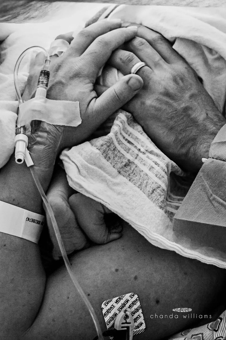 a black and white photo of a person in hospital gown holding a baby with an iv attached to it