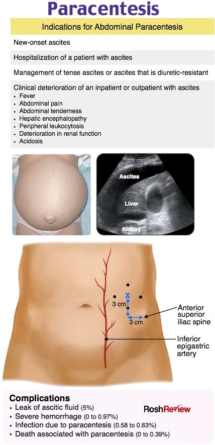 the diagram shows how to use an appliance for breast surgery and what it can do