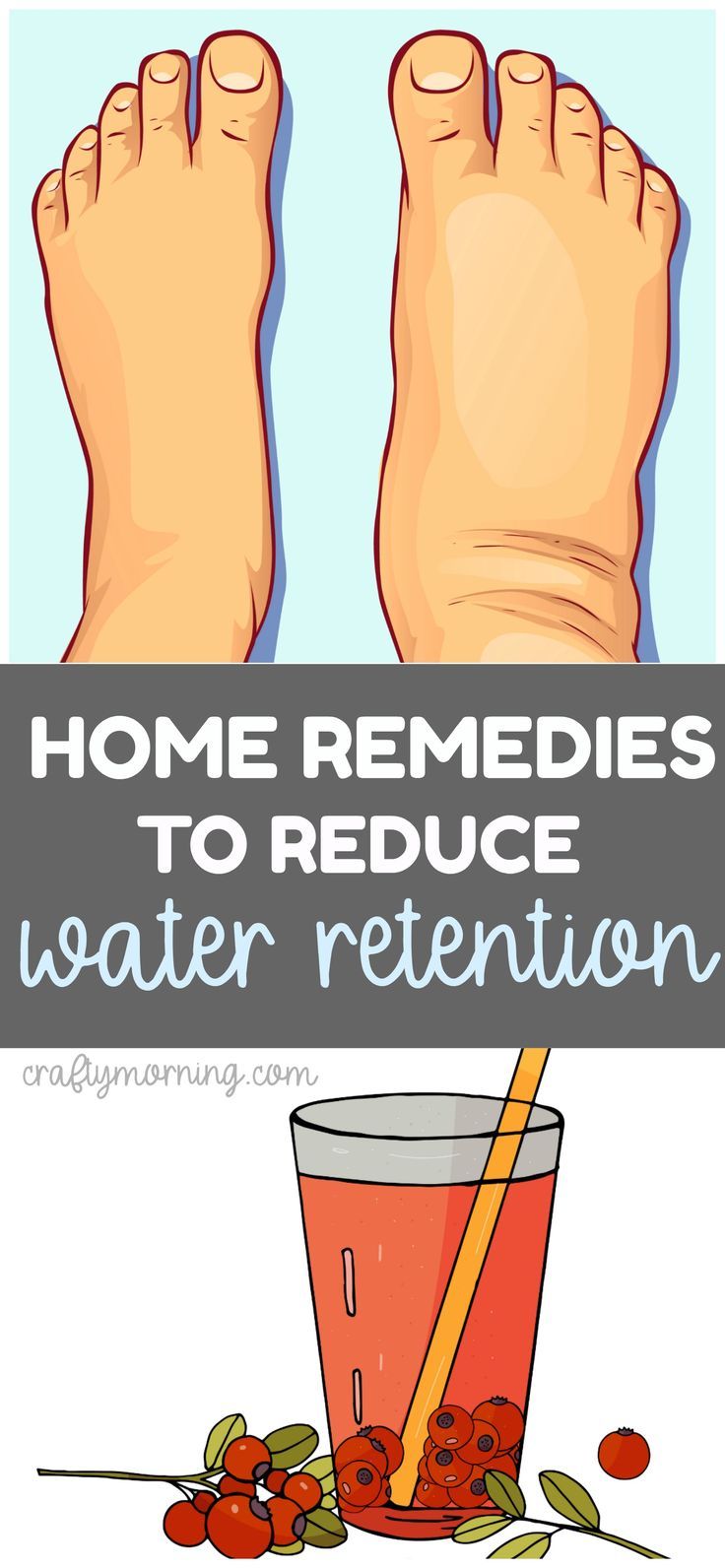 Swelling Remedies, Reduce Water Retention, Water Retention Remedies, Swollen Legs, Body Wrap, Healthy Diet Tips, Water Retention, Daily Health Tips, Good Health Tips