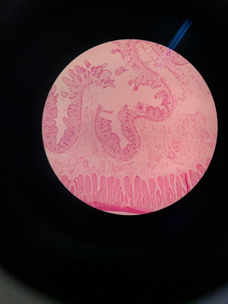 an animal cell is shown in pink light on a black plate with blue straws