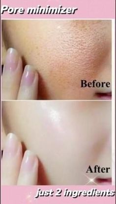 Beginner Skin Care Routine, Mekap Mata, Skin Care Basics, Open Pores, Clear Healthy Skin, Diy Skin Care Routine, Good Skin Tips, Diy Skin Care Recipes, Basic Skin Care Routine