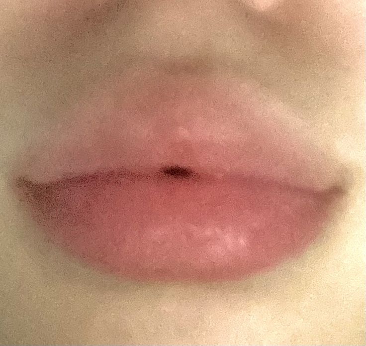 Full Plump Lips Aesthetic, Plump Pouty Lips, Big Round Lips Aesthetic, Angelic Lip Filler, Big Pouty Lips, Naturally Big Lips, Wide Lips Aesthetic, Keyhole Pout Lips, Big Upper Lip