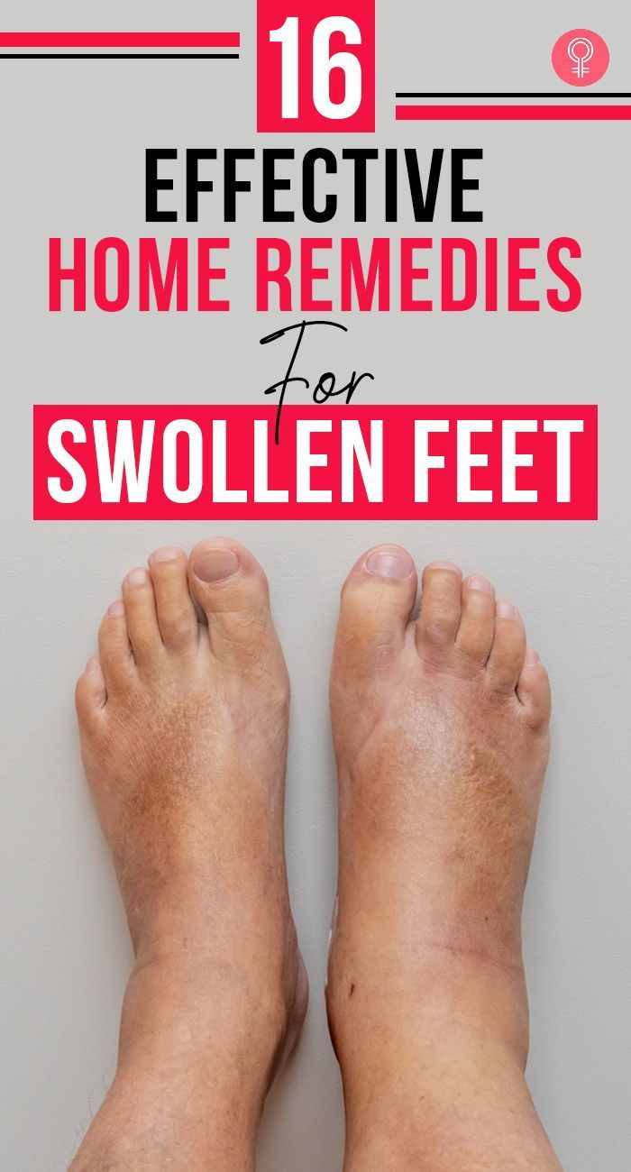 16 Effective Home Remedies For Swollen Feet: It’s time you stop suffering silently and stop treating this as a ‘not serious’ medical condition. A few hours of rest don’t always work in reducing the swelling. Here’s where our article will help you out. #remedies #homeremedies #swollenfeet #health #healthcare #healthcaretips #wellness Swollen Feet Remedies How To Get Rid, Reduce Swelling In Feet Remedies, Swollen Ankles Remedies, Foot Swelling Remedy, Leg Swelling Remedies, Reduce Swelling In Legs And Ankles, Feet Swelling Remedies, Ankle Swelling Remedies, Swollen Ankle Remedies