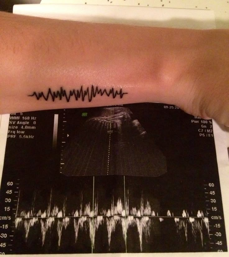 a person's arm with a tattoo on it and sound waves in the background