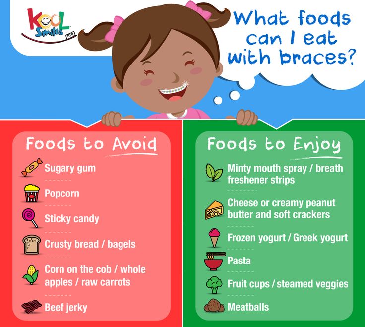 Braces Infographic Braces Food To Avoid, Soft Foods To Eat, Braces Food, Kids Braces, Braces Tips, Getting Braces, Cute Braces, Clear Braces, What Can I Eat