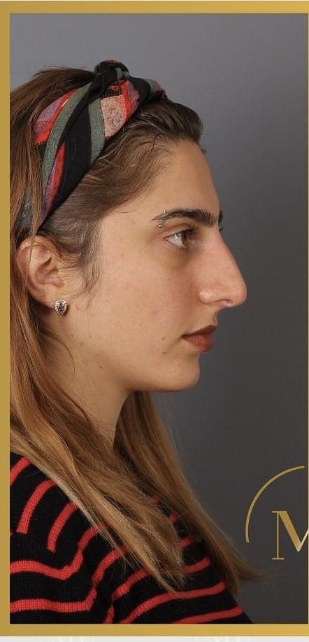 a woman with long hair wearing a headband and looking off to the side, in front of a gray background