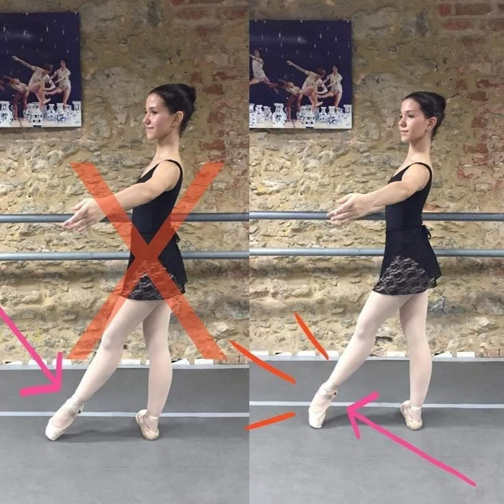 two pictures of a woman in ballet clothes, one with an x on the side