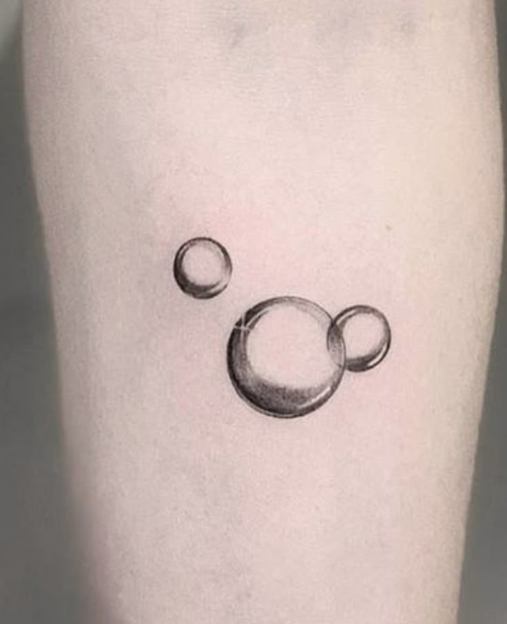 a black and white photo of two bubbles on the right thigh, with one bubble in the middle