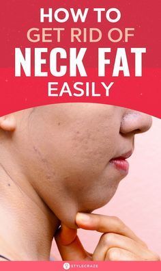 Fat Face Exercises, Jowl Exercises, Loose Face Fat, Neck Fat Exercises, Chin Reduction, Double Chin Exercises, Chin Exercises, Face Fat, Yoga Hair