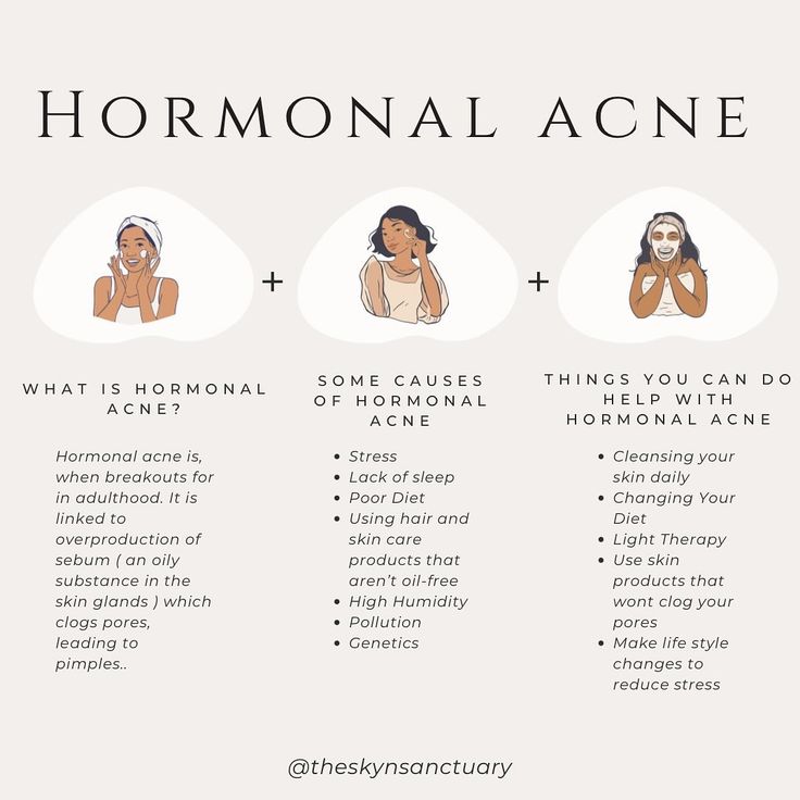 Hormonal acne is when breakouts form in adulthood that could range from blackheads and whiteheads to painful cysts. Hormonal acne is linked to the overproduction of sebum (an oily substance in skin glands), which clogs pores, leading to pimples. Though often unavoidable, hormonal acne can be treated to prevent future breakouts from forming. #hormonalacne #hormonalacnetreatment #hormonebalance #acne #acnesafeproducts #acnefacialtreatment #theskynsanctuary #esthetician #estheticianmeme #estheti... Treating Hormonal Acne, Hormonal Chin Acne, How To Heal Hormonal Acne, How To Clear Hormonal Acne, Esthetics Content, Detox Aesthetic, Hormonal Acne Skincare Routine, Period Pack, The Substance