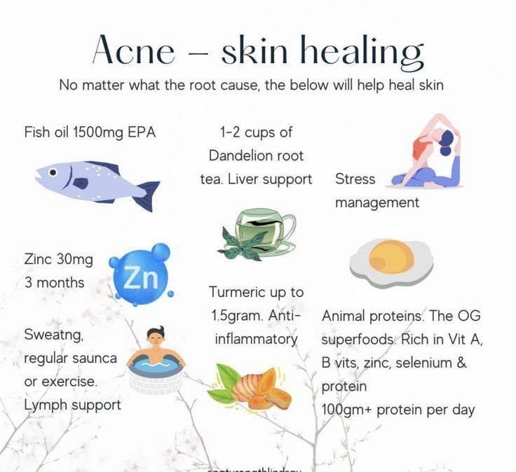 Hormone Nutrition, Hormonal Acne Remedies, Inflammatory Acne, Hormonal Health, Healthy Hormones, Natural Acne Remedies, Natural Acne, Feminine Health, Acne Solutions