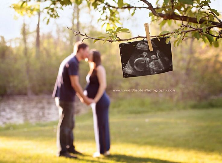 a pregnant couple standing under a tree with an x - ray image hanging from it