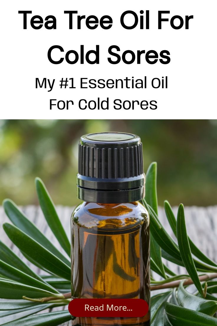 Save this pin to learn how I use tea tree oil for cold sores. If you’re looking for a powerful, natural cold sore remedy, tea tree oil is one of the best essential oils for cold sores. Click here to read more. Oils For A Cold, Cold Sore Remedy Fast, Heal Cold Sores Fast, Cold Sore Remedy Overnight, Cold Sore Essential Oil, Cold Sore Stages, Essential Oils For Cold, Blister Remedies, Natural Cold Sore Remedy