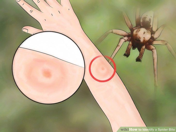 the spider is trying to get out of the human's hand, and it looks like