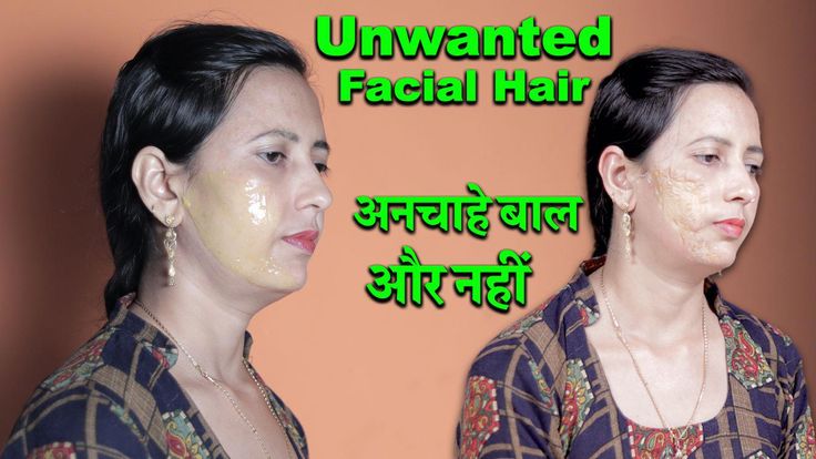 Remove facial Hair (Naturally) | अनचाहे बालों से आज़ादी | Hair removal - Permanent ?#Facialhair  #Hairremoval    #RemoveUnwantedhair   #Healthcity #Suman  #P... Unwanted Facial Hair, Healthy Teas, Preventative Health, Hair Removal Permanent, Body Hair Removal, Unwanted Hair Removal, Smart Things, Unwanted Hair, Body Hair