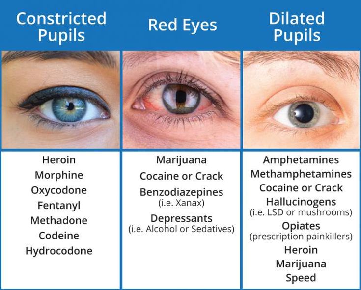 the different types of eyes are labeled in this diagram, which shows what they look like