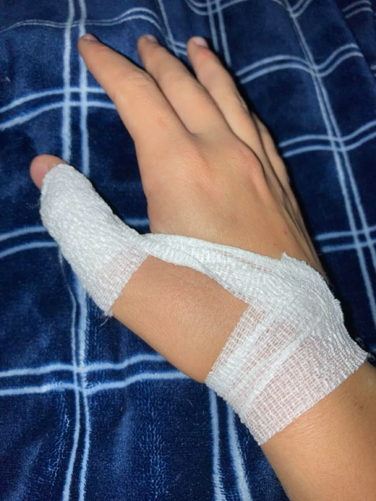 bandaged hand laying on top of a blue blanket