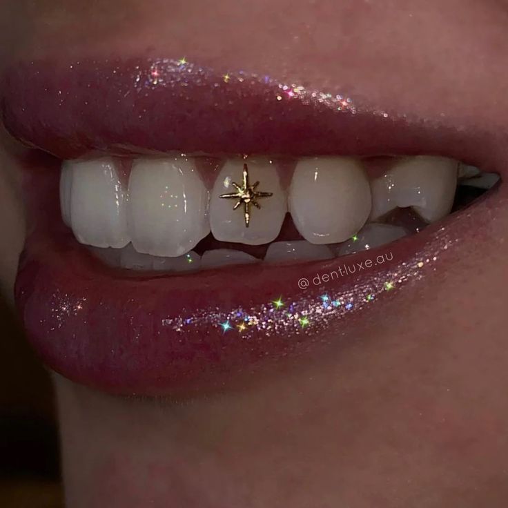 a close up of a person's mouth with white teeth and gold stars on it