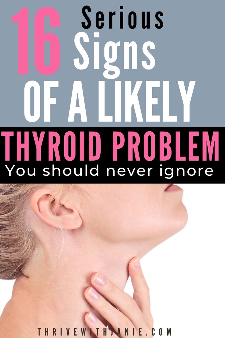 Low Thyroid Remedies, Thyroid Remedies, Low Thyroid, Thyroid Symptoms, Hormonal Imbalance, Thyroid Issues, Health Signs, Tongue Health, Thyroid Health