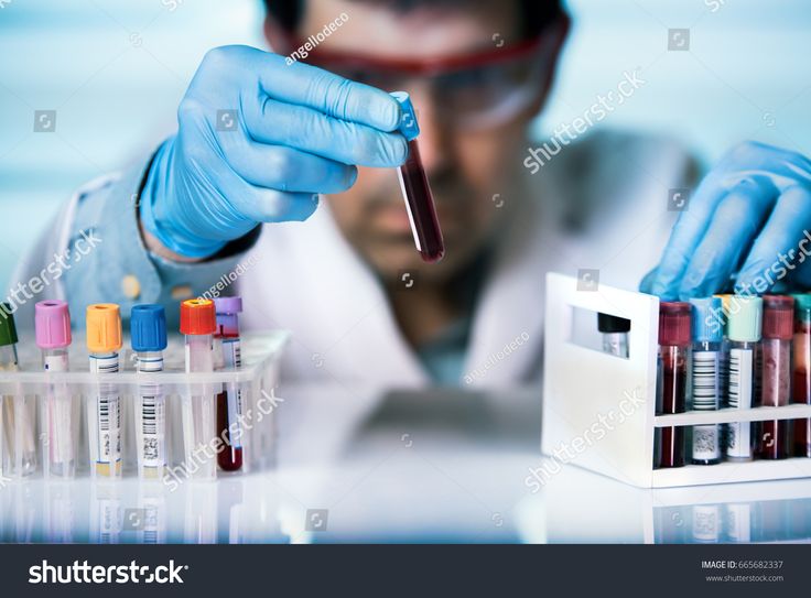 a man in white lab coat and blue gloves holding test tubes