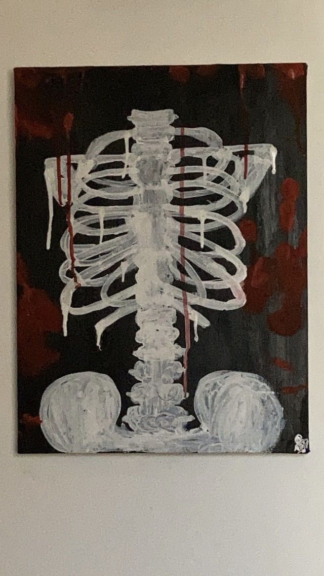 a painting on the wall shows a skeleton and bones with blood dripping from its ribs