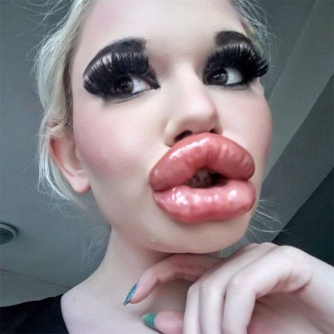 Big Lip Filler, Lip Filler Memes Funny, Big Lips Funny, Bad Lip Filler, Chav Makeup, Mouth Sketch, Lip Sketch, Mouth Makeup, Fish Lips