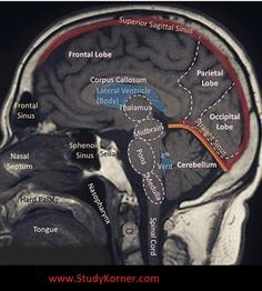 an mri image shows the location of the cranin in the brain and surrounding areas