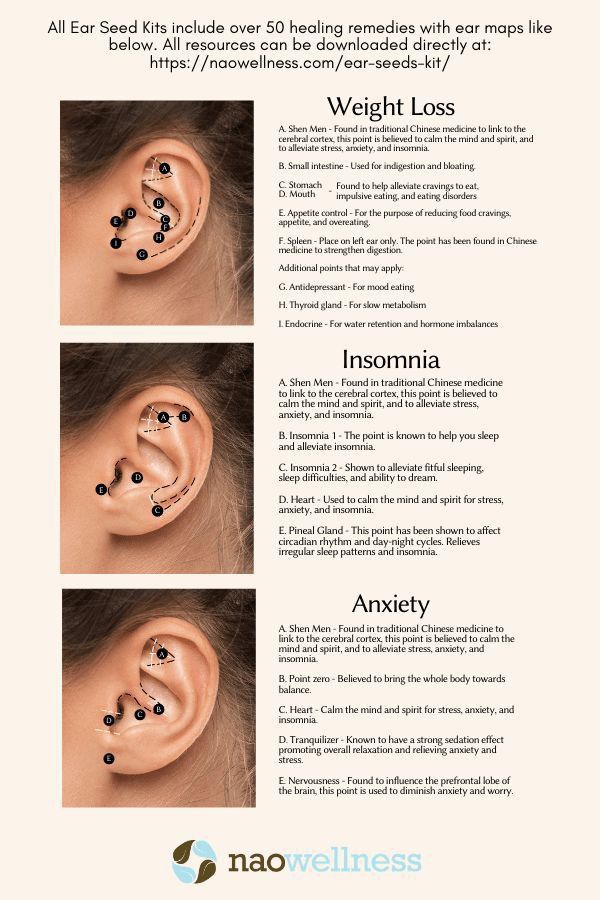 Ear Acupressure Points, Ear Reflexology, Ear Seeds, Ear Piercings Chart, Seed Kit, Acupressure Points, Trening Pilates, Natural Health Remedies, The Ear