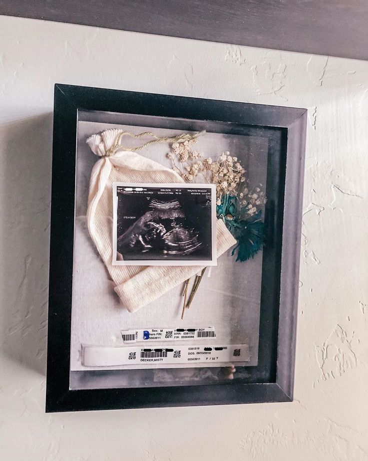 a framed photograph of a baby's diaper and flowers