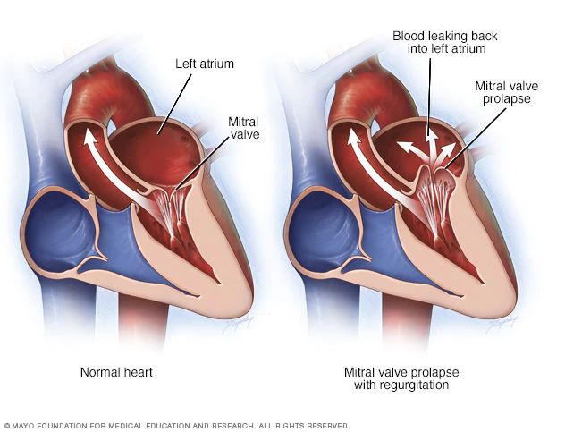 two views of the human heart with labels on each side and blood vessels labeled in red