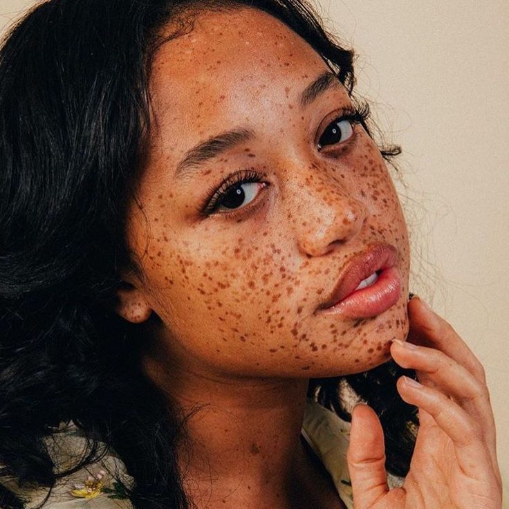 a woman with freckles on her face holding a cell phone to her ear