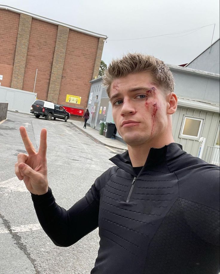 a young man with blood all over his face standing in front of a parking lot