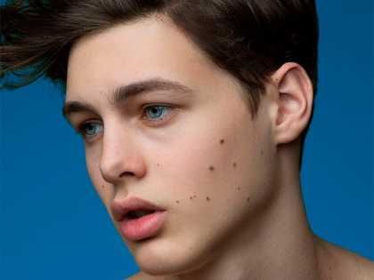 a young man with freckles on his face and chest looking at the camera