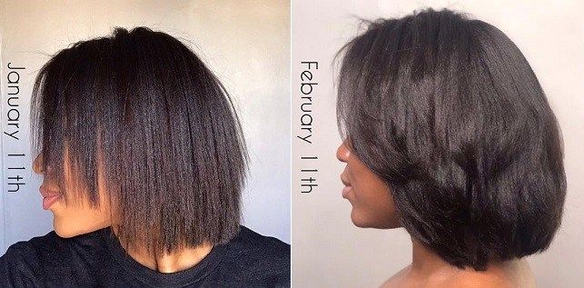 Is rice water good for hair? Pros say it stimulates hair growth, helps alopecia and dandruff. Is it a new substitute for the coconut oil then? Yes and no! Rice Water For Hair, Fermented Rice Water, Slow Hair Growth, Rosemary Lavender, Skin Tags, Hair Specialist, Hair Massage, Rice Water, New Hair Growth